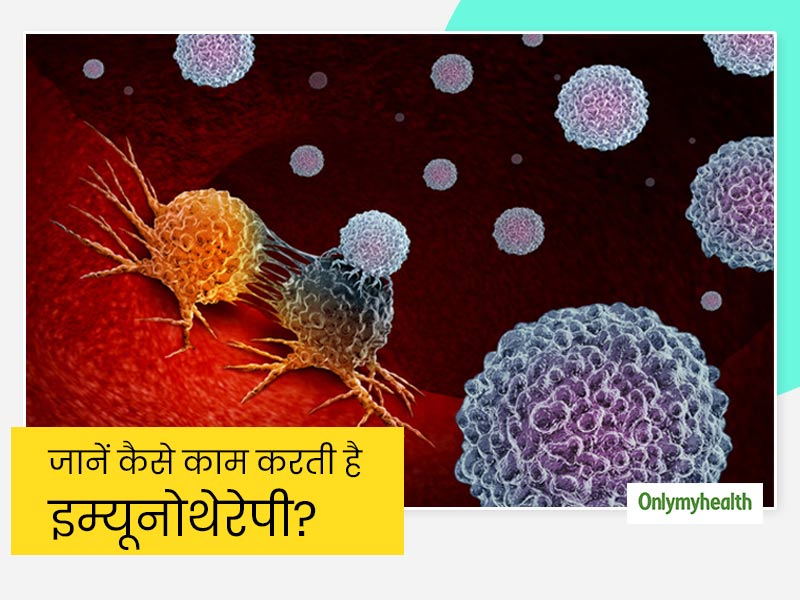 Immunotherapy: कैंसर से लड़ने के लिए असरदार है इम्यूनोथेरेपी, जानें क्या है इसके प्रकार और कैसे करती है काम