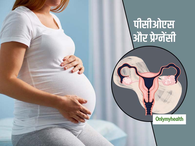 महिलाओं की फर्टिलिटी को प्रभावित करता है PCOS, जानें पीसीओएस के बावजूद गर्भवती होने की संभावनाएं?