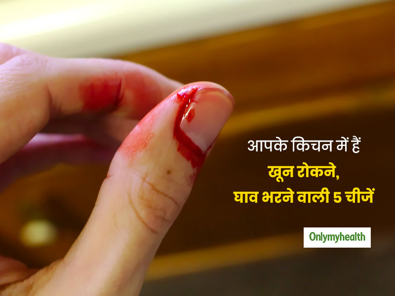 कटने-छिलने या चोट लगने पर किचन में मौजूद इन 5 चीजों का करें इस्तेमाल, तेजी से भरेगा घाव और नहीं होगा इंफेक्शन