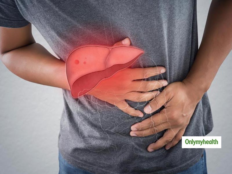 Fatty Liver: इन 5 प्राकृतिक तरीकों से करें फैटी लिवर का उपचार, हमेशा सलामत रहेगा आपका Liver