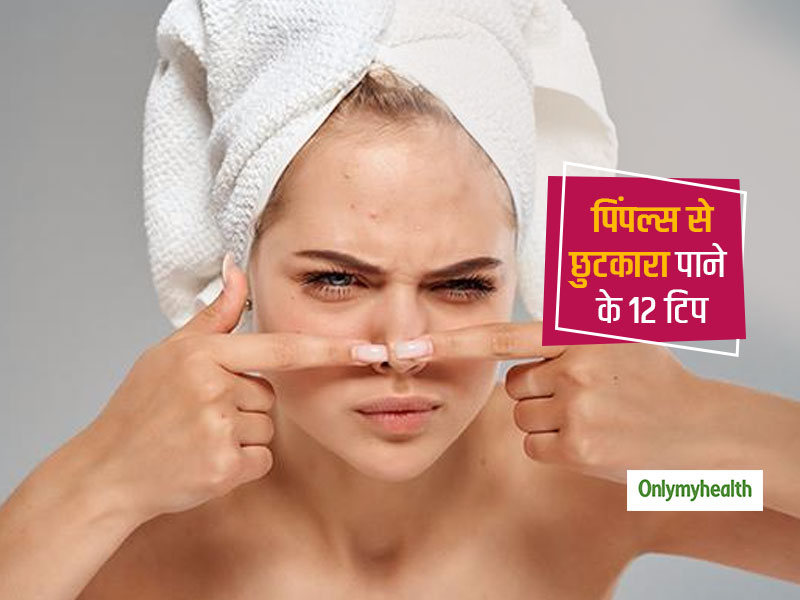 चेहरे की खूबसूरती पर पिंपल्स ने लगाया बदसूरती का ठप्पा! फॉलो करें 12 टिप और पिंपल्स से छुटकारा, स्किन होगी साफ