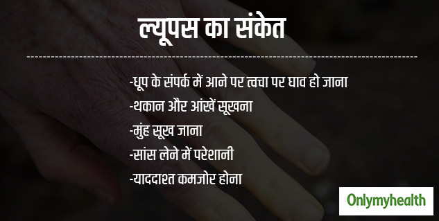 insidelupusdiseasesigns