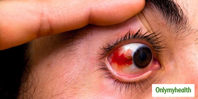 insiderheumatoidarthritiseffectsoneyes