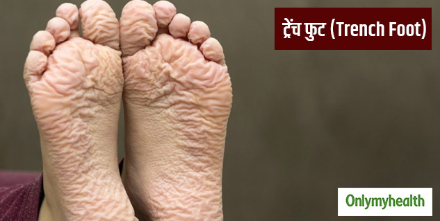 insidetrenchfoot