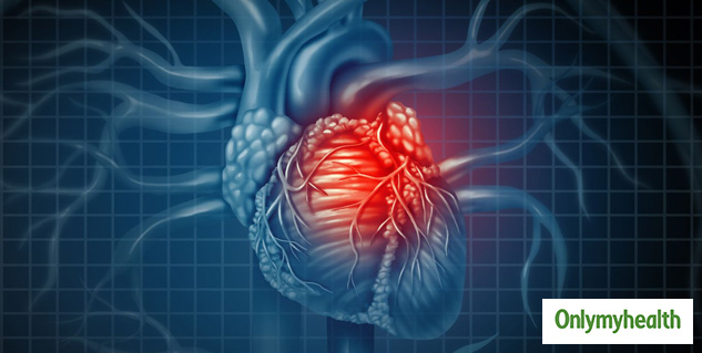 risk of death from heart attack in women