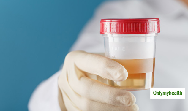urine test