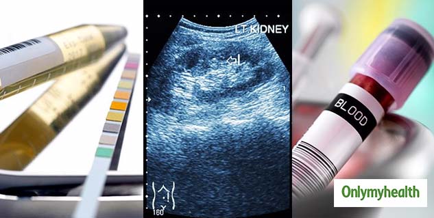 Ultrasound Therapy For Kidney