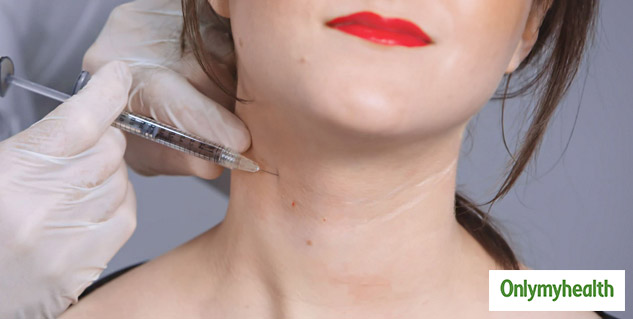 botox for neck wrinkles