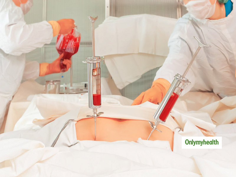 Know Everything About Bone Marrow Transplant By Dr Sumeet Mirgh