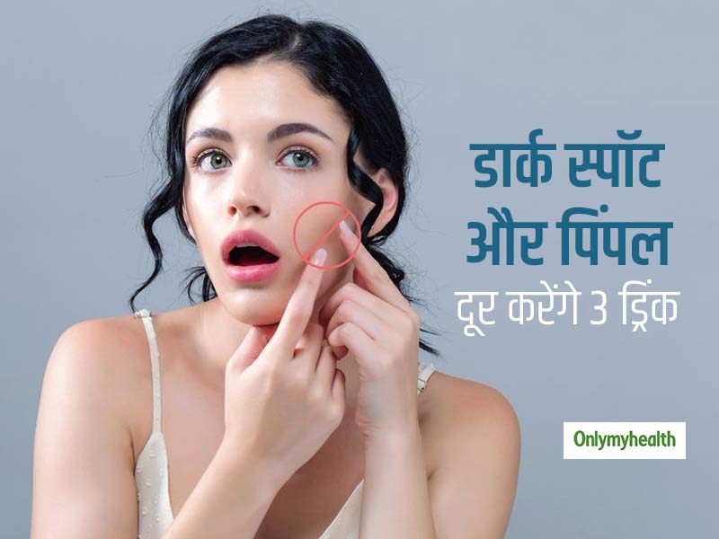 जिद्दी पिंपल और डार्क स्पॉट को कुछ दिनों में ही गायब कर देंगे ये 3 ड्रिंक, जानें इन्हें बनाने का तरीका और फायद