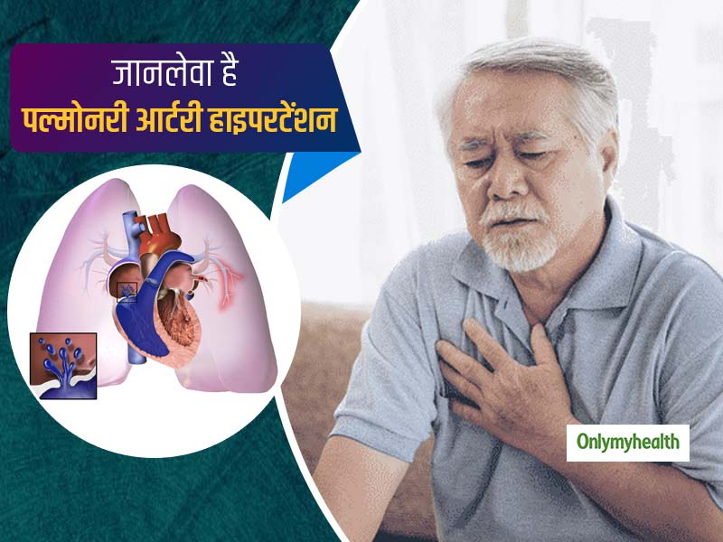Pulmonary Arterial Hypertension: जानलेवा है पल्मोनरी आर्टरी हाइपरटेंशन, जानें कारण, लक्षण और बचाव के तरीके
