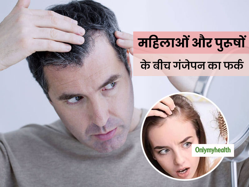 महिलाओं और पुरूषों के गंजेपन में होता है फर्क, जानें गंजेपन के लक्षणों में अंतर