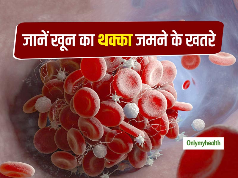 रक्त वाहिकाओं में खून का थक्का जमने (ब्लड क्लॉटिंग) के खतरे क्या हैं और इसे कैसे रोकें?