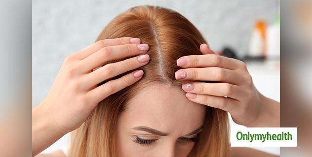 inside_SYPTOMSOFBALDNESS