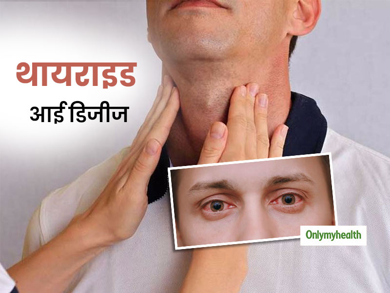 Thyroid Awareness Month: थाइराइड के कारण हो सकती है ड्राई आईज की परेशानी, जानें इसके कारण और उपाय