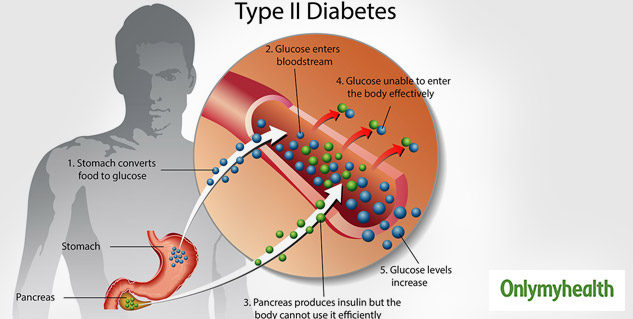 Inside_type2diabetes