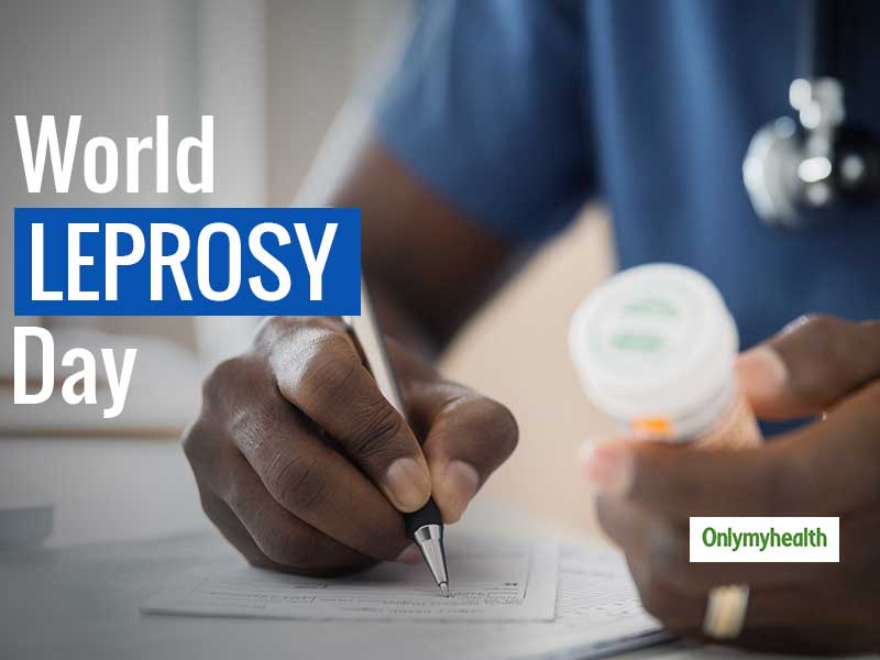 Leprosy Day 2020: Bust The Myths, Learn The Facts About Leprosy