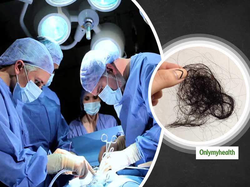 13 साल की बच्ची के पेट से निकले आधा किलो बाल और खाली शैम्पू के पाउच, जानें पूरा मामला