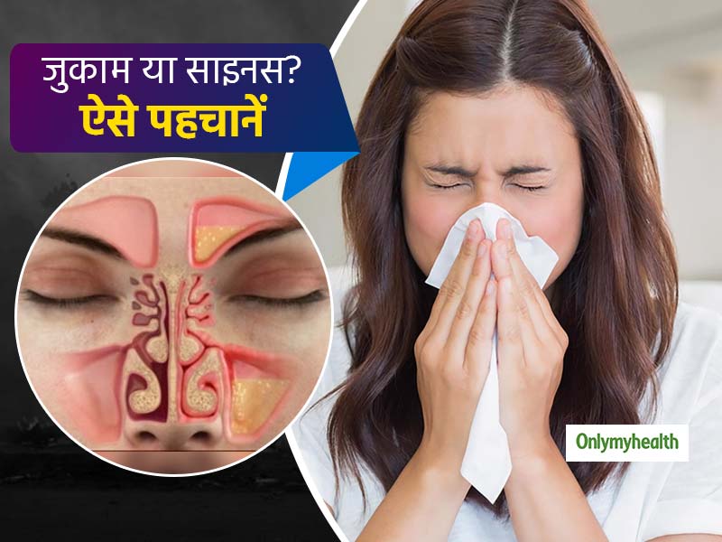 कहीं आपको जुकाम लगने वाला रोग साइनस इंफेक्शन तो नहीं? जानें कैसे पहचानें दोनों में अंतर