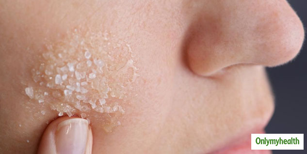 Backing Soda For pores