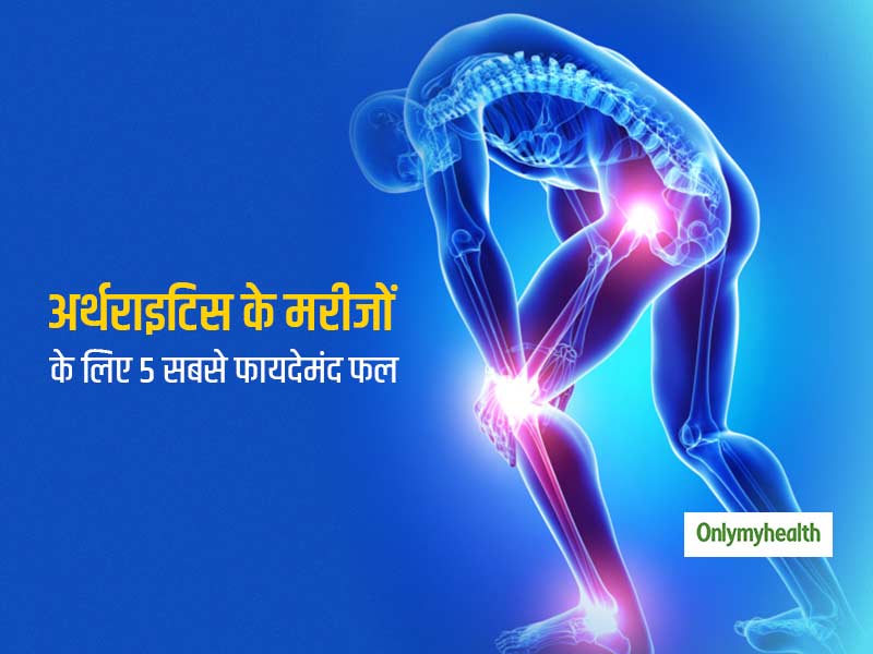 अर्थराइटिस के मरीजों को जरूर खाने चाहिए ये 5 फल, दर्द और सूरज होगा दूर और जोड़ रहेंगे स्वस्थ