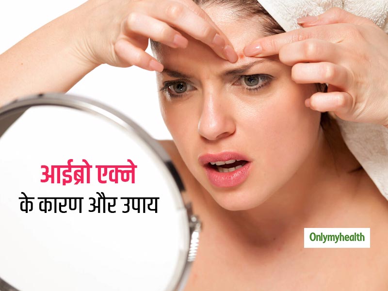 इन 4 कारणों से आईब्रो पर लगातार होते हैं एक्ने और पिंपल्स, इनसे छुटकारा पाने के लिए आजमाएं ये आसान उपाय