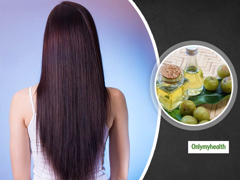 Amla Hair Oil: बालों का झड़ना, सफेद होना और डैंड्रफ का रामबाण उपाय है आंवले का तेल, जानें घर में बनाने का तरीका