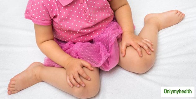 Hip Dysplasia In Symptoms