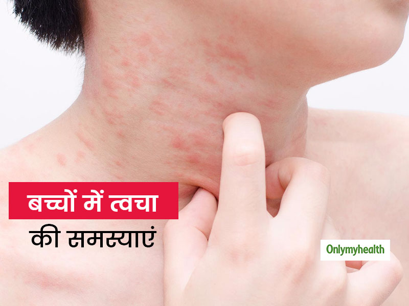 गर्मियों में आपके बच्चे की त्वचा भी हो रही है खराब? जानें क्या है इसका कारण और बचाव