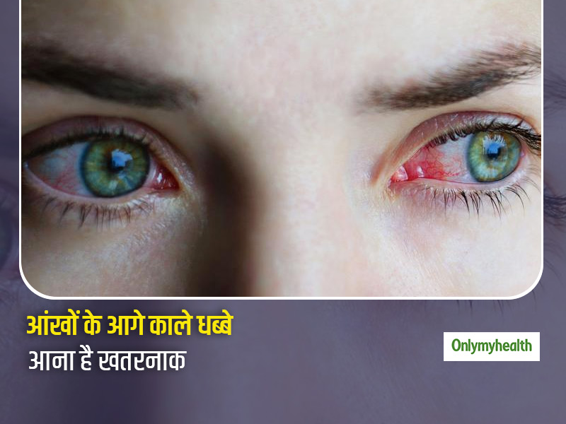 आंखों के आगे अचानक काले धब्बे आना हो सकता है फ्लोटर्स रोग का संकेत, जानें क्या हैं इसके कारण और बचाव