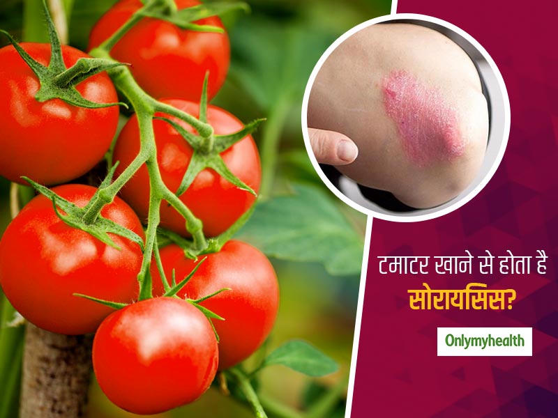 टमाटर खाने से फटती है हाथ-पैर की स्किन और निकलता है खून? जानें कितना सही है ये दावा और क्या है इसकी सच्चाई
