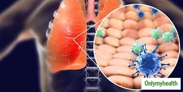 coronavirus infection