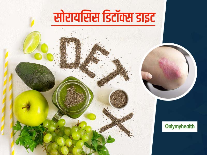 सोरायसिस में फायदेमंद है डिटॉक्स डाइट, जानें क्या है सोरायसिस डिटॉक्स डाइट और इसके फायदे
