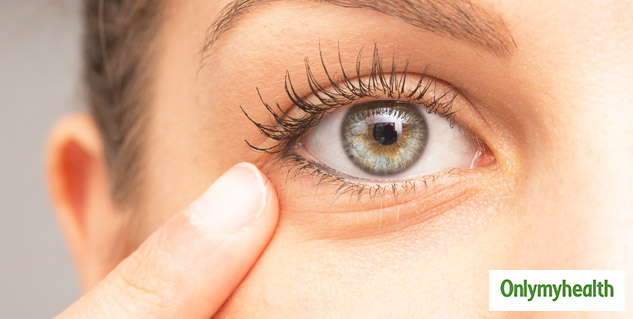 wrinkles around eyes