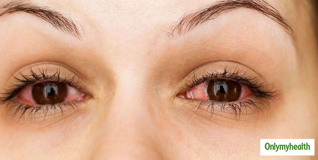 eye problems