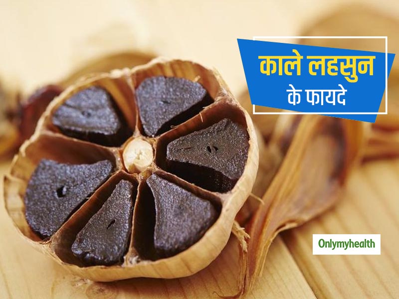 सफेद लहसुन ही नहीं बल्कि काला लहसुन भी है आपके लिए फायदेमंद, कई बीमारियों को करता है दूर