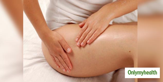 Fact and Myths About Body Cellulite