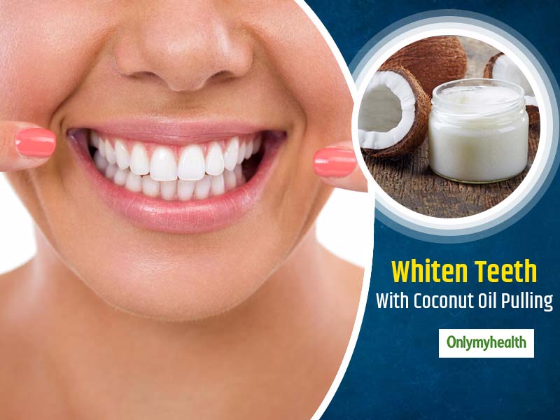 World Oral Health Day 2020: Benefits Of Coconut Oil Pulling For Oral Health