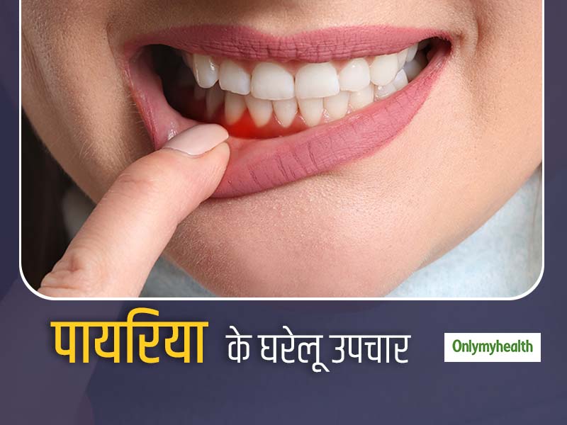 मसूड़ों में दर्द और सूजन होना हो सकता है पायरिया का संकेत, इन घरेलू उपचार से पाएं जल्द राहत