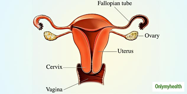 PCOS