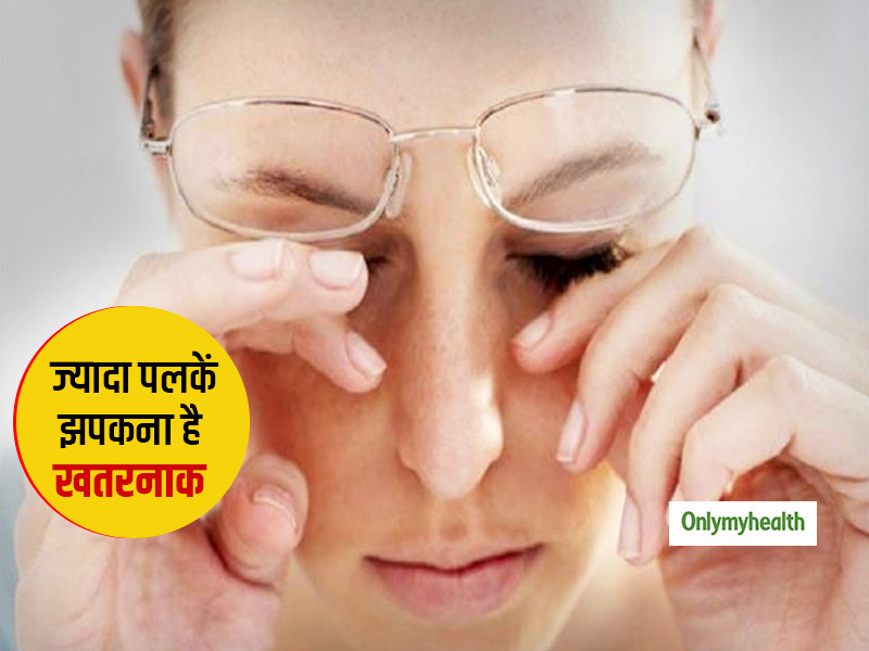 Blepharospasm Disease: पलकों का बार-बार झपकना हो सकता है ब्लेफरोस्पाज्म रोग, जानें क्या है इलाज