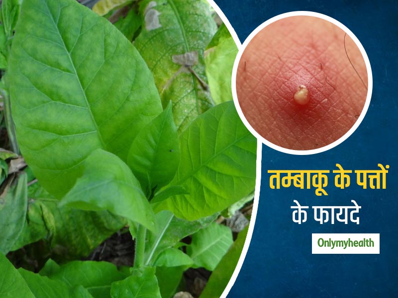 तम्बाकू के पत्तों को सेंककर बांधने से ठीक हो जाते हैं फोड़े-फुंसियां, जानिए और क्या-क्या हैं इसके फायदे