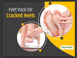 Do You Want An Easy At-Home Solution For Cracked Heels? We Have Got Some For You