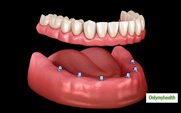 oral health and artificial teeth