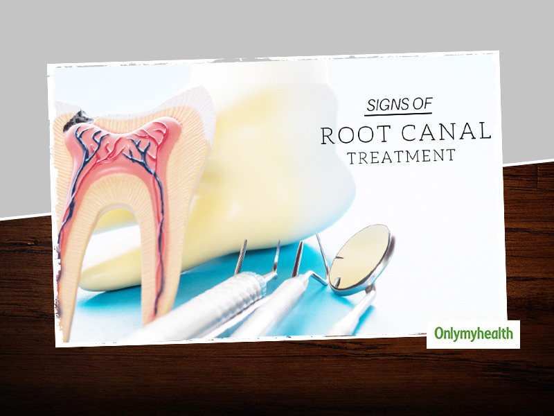 These Signs And Symptoms May Indicate Towards A Root Canal Treatment! Watch Out!