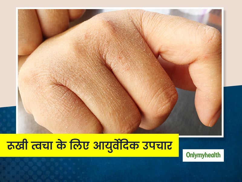 Dry Skin in Winters: सर्दियों में त्वचा के रूखेपन को दूर करने के लिए आप भी अपना सकते हैं ये आसान घरेलू तरीके