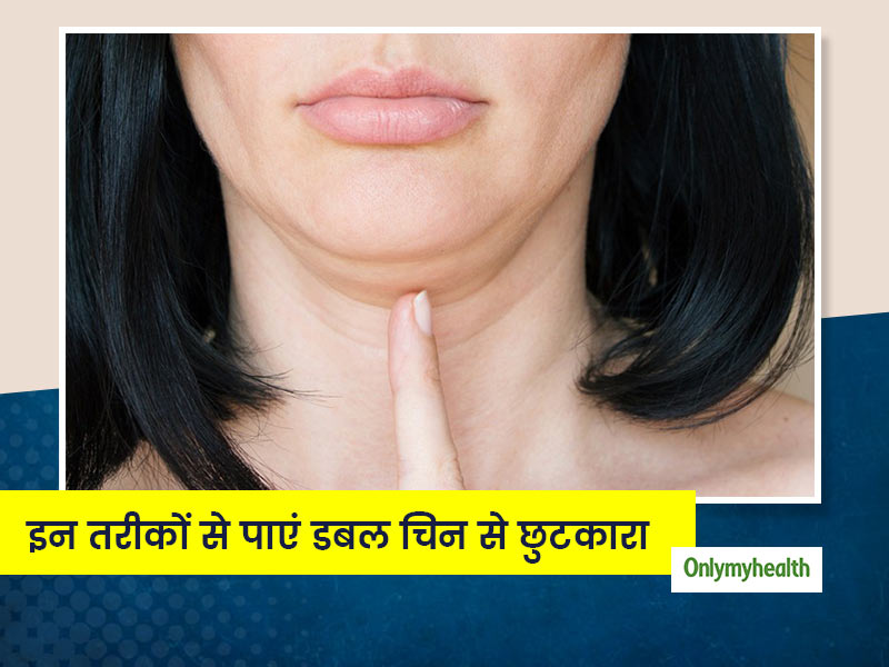 इन 5 घरेलू नुस्खे की मदद से अपनी डबल चिन की समस्या को करें दूर, जानें क्या है करने का तरीका