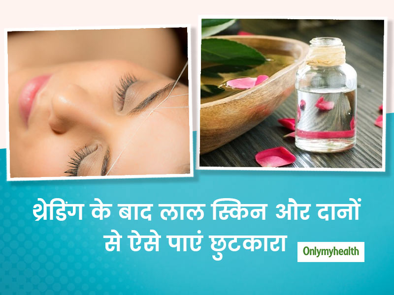थ्रेडिंग के बाद स्किन क्यों हो जाती है लाल? जानिए स्किन रेडनेस से छुटकारा पाने के घरेलू उपचार
