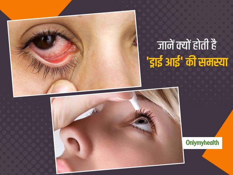 ड्राई आई की समस्या से आप भी हैं परेशान? तो जान लें किन कारणों से होता है ऐसा