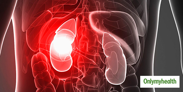 Mishti Mukherjee Dies Due To Kidney Failure